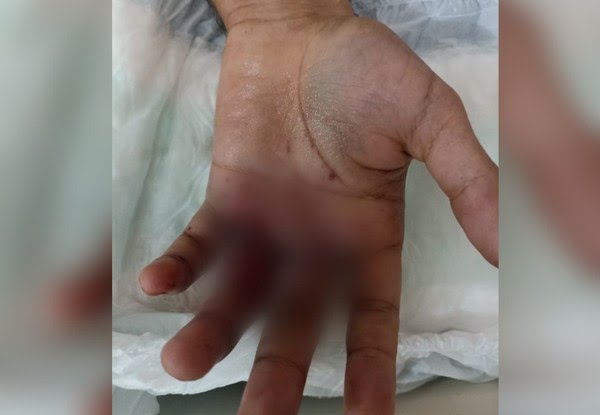 Pais de jovens envolvidos em festa de aniversário em que bolo explodiu acreditam que ideia foi inspirada em vídeos da internet